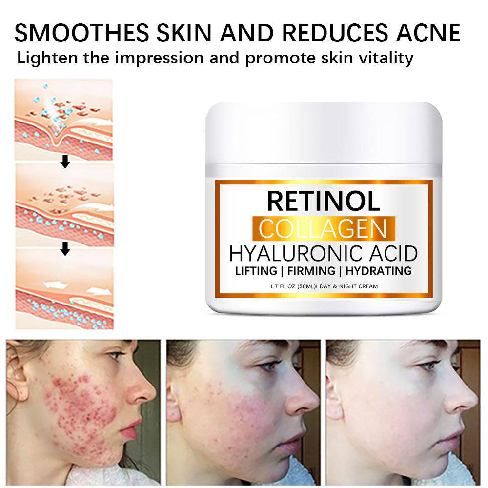 Retinol-Kollagen-Fusion 